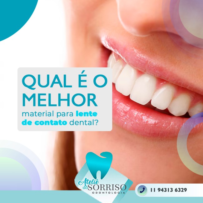 Qual é o melhor material para lente de contato dental?