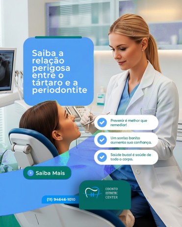 Saiba a relação perigosa entre o tártaro e a periodontite