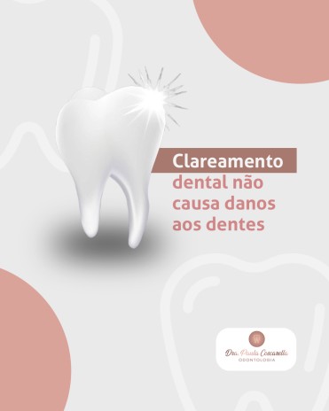 Clareamento dental não causa danos aos dentes