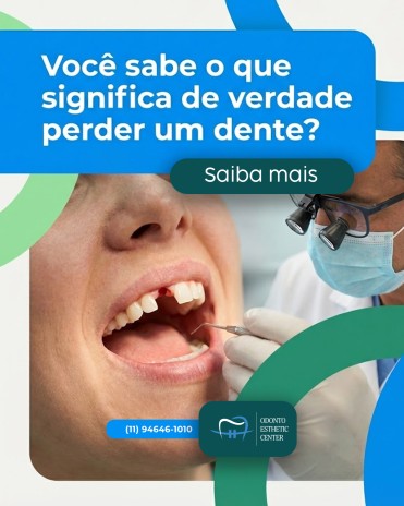 Você sabe o que significa de verdade perder um dente?