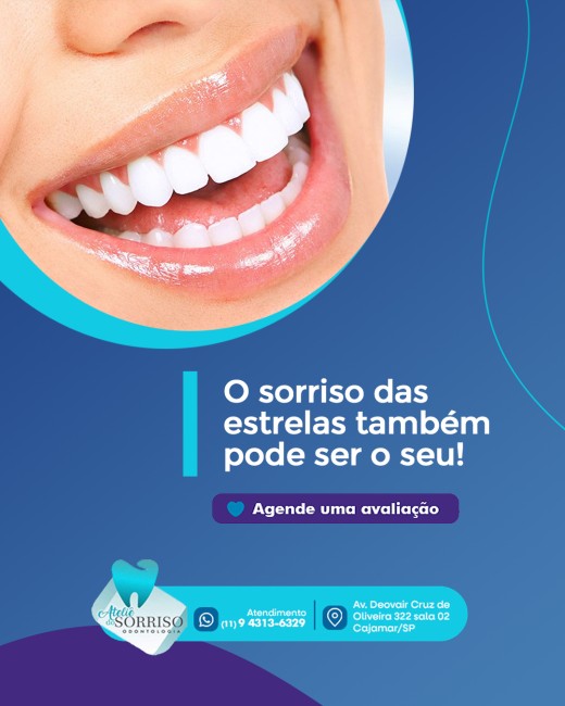 O sorriso das estrelas também pode ser o seu