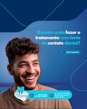 Quanto custa fazer o tratamento com lente de contato dental?