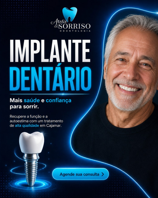 IMPLANTE DENTÁRIO