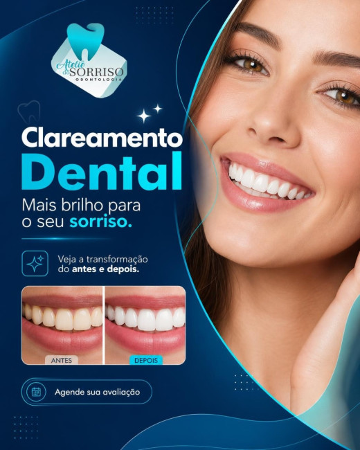 Clareamento Dental